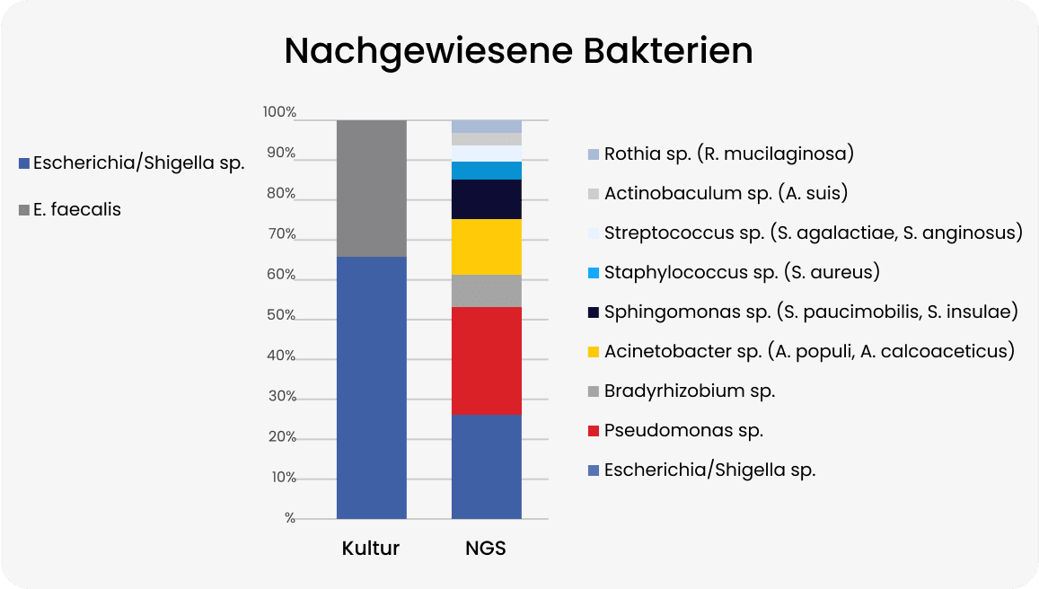 bacteria in urine image