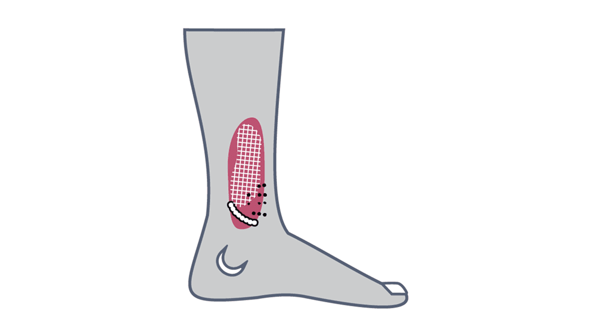 Wound life threatening image